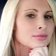 CoolSculpting Michelle Raby